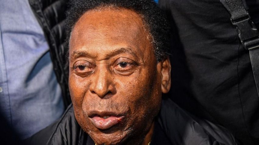 BEOL – Rosszabbodott Pelé állapota, karácsonyra is kórházban marad
