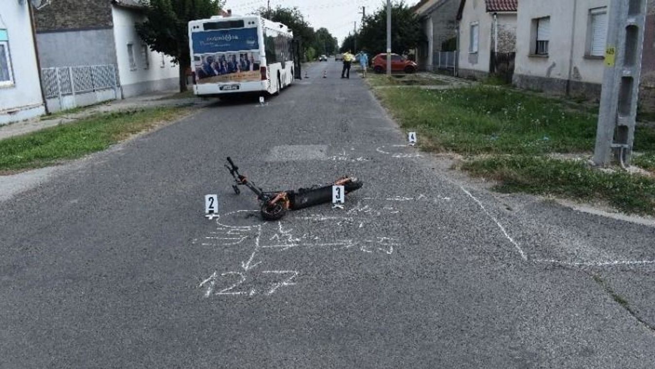Életveszélyes sérüléseket szenvedett egy tinédzser, amikor rollerrel busznak ütközött